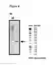 Fig. 08 - Recombinant microorganism for improved production of fine chemicals