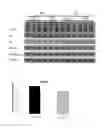 Fig. 03 - Composition for preventing and treating degenerative brain disease using novel lactic acid bacteria