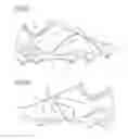 Fig. 07 - Method of non-woven fabrics including a component