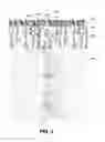 Fig. 02 - Supports for helical piles and anchors