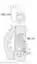 Fig. 10 - Lock for a wear assembly