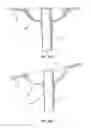 Fig. 44 - Repetitive pulsed electric discharge drills including downhole formation evaluation