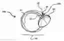 Fig. 01 - SUCTION CUP SECURING DEVICE INCORPORATING A BI-STABLE RIBBON SPRING