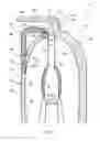 Fig. 08 - Torque converter with a finger-tabbed brazed inertia ring