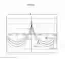 Fig. 04 - Strain wave gearing with compound meshing that involves congruity of tooth surfaces