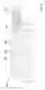 Fig. 05 - Detection device and lubricant distributor