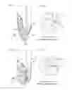Fig. 20 - Particle dispersion device and particle dispersion method