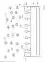 Fig. 08 - Electrochemical detector