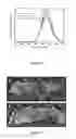 Fig. 06 - Device for visual detection of bilirubin