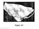 Fig. 07 - Device for visual detection of bilirubin