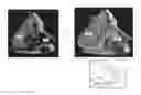 Fig. 01 - Visualization of anatomical cavities