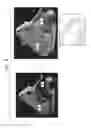 Fig. 03 - Visualization of anatomical cavities
