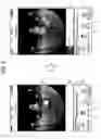 Fig. 06 - Information processing apparatus for creating an animation from a spherical image