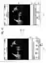 Fig. 24 - Information processing apparatus for creating an animation from a spherical image