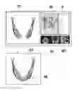 Fig. 01 - MEDICAL IMAGE MODELING SYSTEM AND MEDICAL IMAGE MODELING METHOD