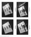 Fig. 06 - Self laminating wristband