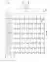 Fig. 14 - Method and apparatus for memory power and/or area reduction