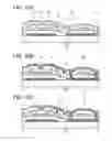Fig. 11 - Semiconductor device comprising resistor comprising metal oxide
