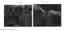 Fig. 05 - DISCRETE CARBON NANOTUBES AND MICROFIBER COMPOSITES