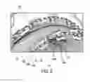 Fig. 07 - PRE-FORMED COIL, WINDING STRUCTURE, AND STATOR FOR A GENERATOR OF A WIND TURBINE AND METHOD FOR PRODUCING A STATOR