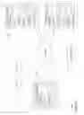 Fig. 07 - CAMERA PEEK INTO TURN