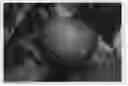 Fig. 01 - Peach tree named 'Crisplova'