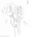 Fig. 06 - Retention Lanyard