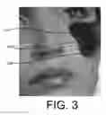 Fig. 03 - MAKEUP BRUSH FOR DUAL MAKEUP APPLICATION