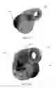 Fig. 24 - Electronic residential tissue dispenser