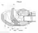 Fig. 07 - Endoscope having attachable/detachable raise base