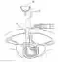 Fig. 01 - SURGICAL TISSUE RECOGNITION AND NAVIGATION APARATUS AND METHOD