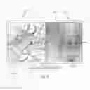 Fig. 10 - SURGICAL TISSUE RECOGNITION AND NAVIGATION APARATUS AND METHOD