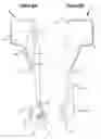 Fig. 04 - Video laryngoscopes
