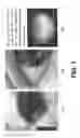 Fig. 02 - Smartphone-based handheld ophthalmic examination devices