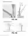 Fig. 10 - Smartphone-based handheld ophthalmic examination devices