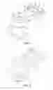 Fig. 03 - Portable retinography device