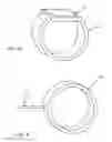 Fig. 08 - Cuff designs and methods