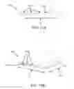Fig. 11 - Cuff designs and methods