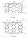 Fig. 15 - Cuff designs and methods