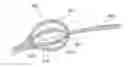 Fig. 01 - Systems and methods for tracking an intrabody catheter