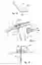 Fig. 07 - Medical device, apparatus, and surgical method