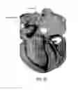 Fig. 34 - Streakline visualization apparatus and method