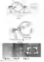 Fig. 02 - Methods for performing bi-planar fluoroscopy-guided surgical procedures