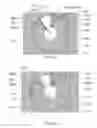 Fig. 07 - X-ray reduction system