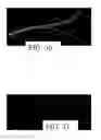 Fig. 19 - Synthetic data-driven hemodynamic determination in medical imaging
