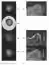 Fig. 06 - Waveform enhanced reflection and margin boundary characterization for ultrasound tomography