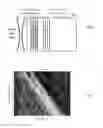 Fig. 04 - Sparse tracking in acoustic radiation force impulse imaging