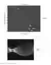 Fig. 05 - Sparse tracking in acoustic radiation force impulse imaging
