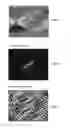 Fig. 06 - Sparse tracking in acoustic radiation force impulse imaging