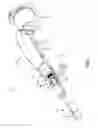 Fig. 02 - APPARATUS TO ALLOW BIOPSY SAMPLE VISUALIZATION DURING TISSUE REMOVAL